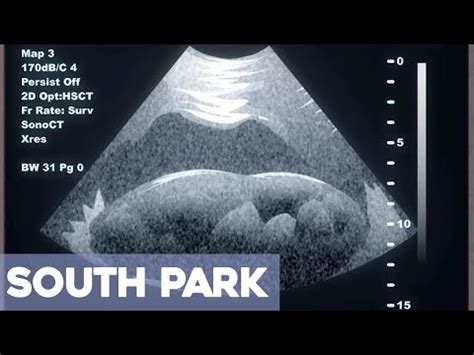 randy's severely constipated|Randy's Ultrasound .